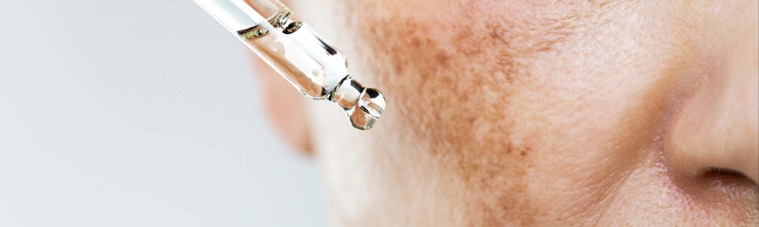 Δυσχρωμίες - VAITSI Cosmetics