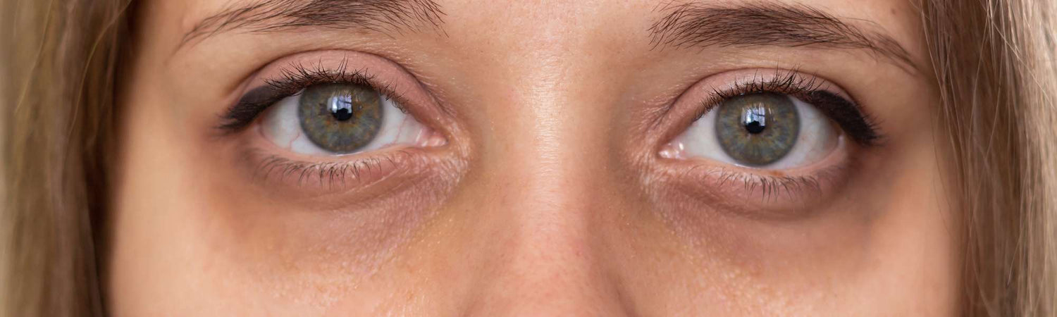 Μαύροι κύκλοι - VAITSI Cosmetics