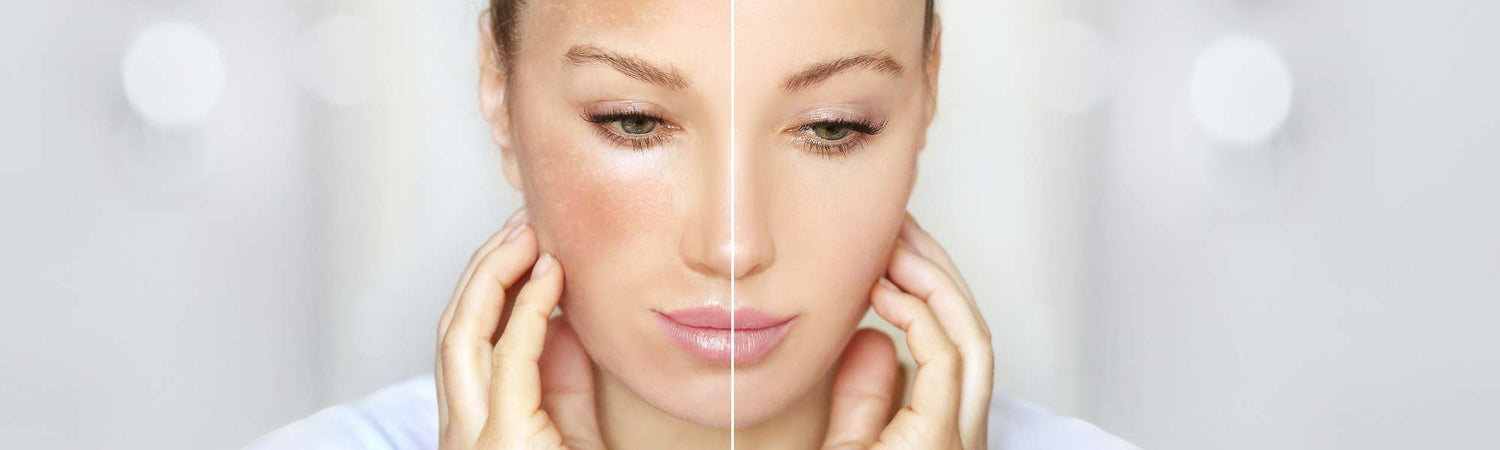 Ωφ. Περιποίηση Φωτεινότητας Δέρματος - VAITSI Cosmetics