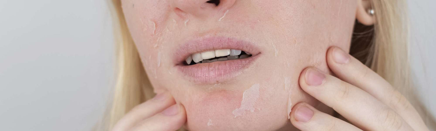 Ωφέλιμη Περιποίηση για Ξηρές Επιδερμίδες - VAITSI Cosmetics