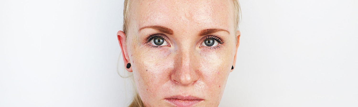 Ωφέλιμη Περιποίηση για Λιπαρές Επιδερμίδες - VAITSI Cosmetics