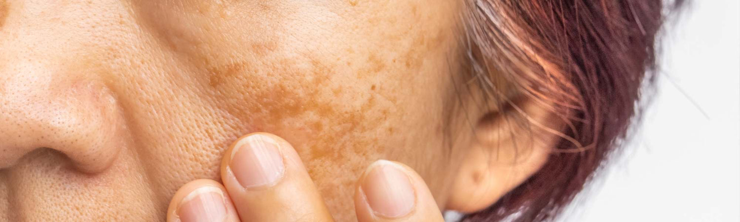 Πανάδες - VAITSI Cosmetics