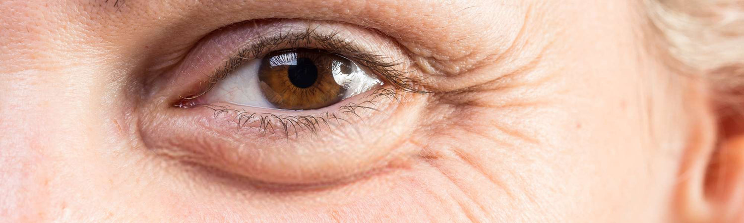 Σακούλες Ματιών - VAITSI Cosmetics